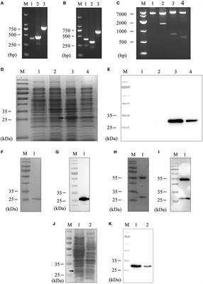 The Fab Fragment of a Human Anti-Siglec-9 Monoclonal Antibody Suppresses LPS-Induced Inflammatory Responses in Human Macrophages